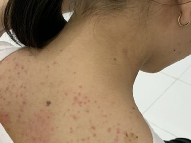 Where Is The Best Skin Prevention Treatment In Hcmc?