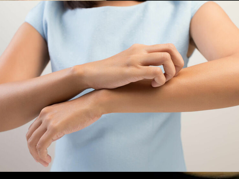 Why Infection With Itens Itchy Skin Allergies Increased Leukocytosis