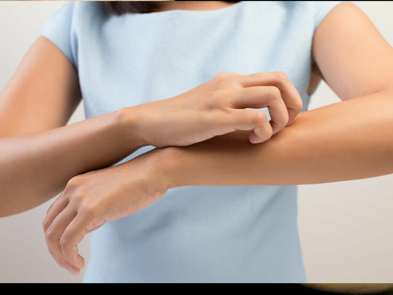 Itchy Skin Rashes Are Caused By Helminth Infections